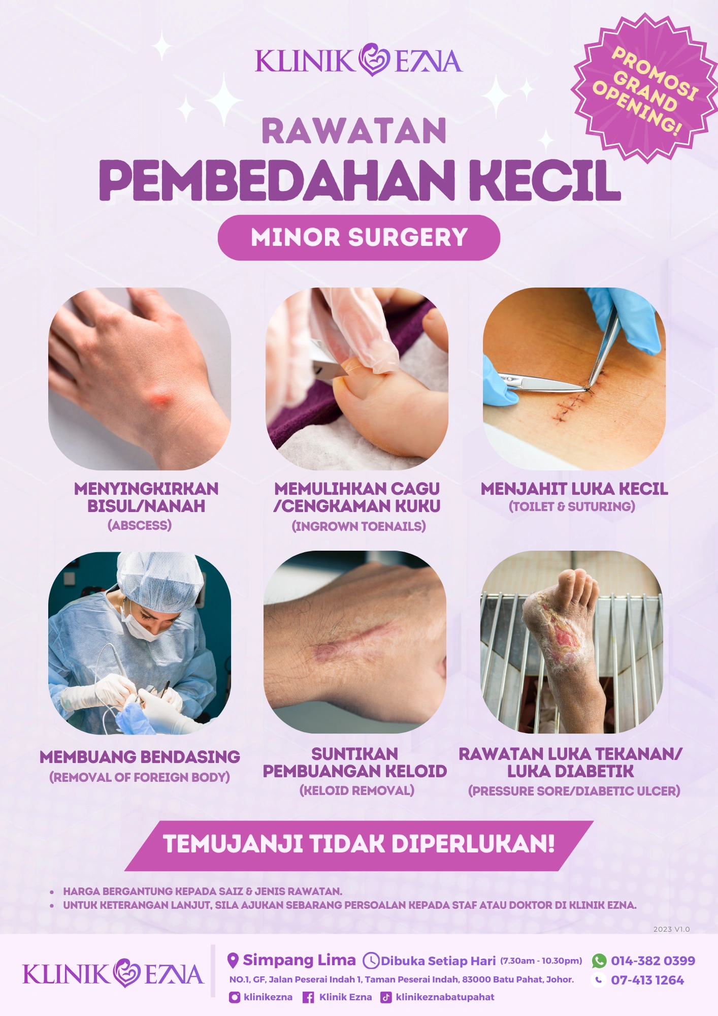 Rawatan Pembedahan Kecil Di Batu Pahat Klinik Ezna