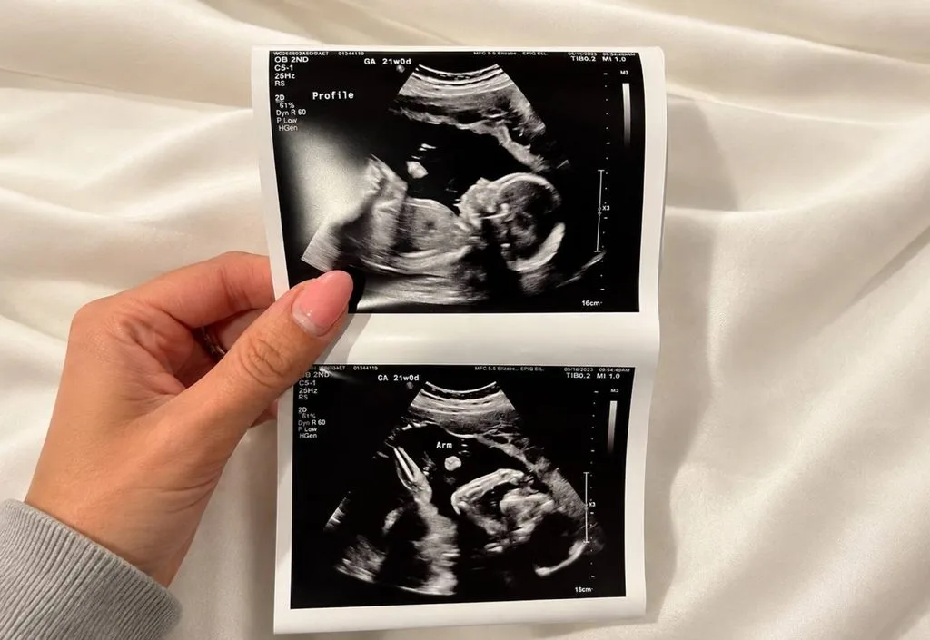Klinik Scan Baby Batu Pahat